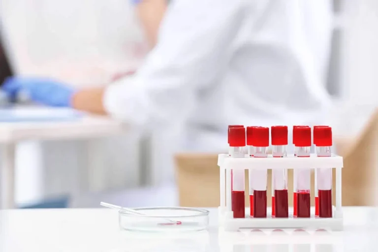 A rack of red-capped blood sample tubes on a white laboratory counter, representing a comprehensive blood work panel.