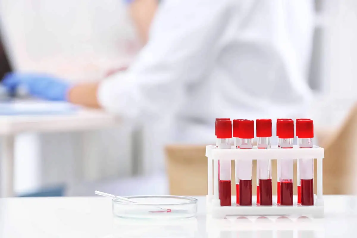 A rack of red-capped blood sample tubes on a white laboratory counter, representing a comprehensive blood work panel.