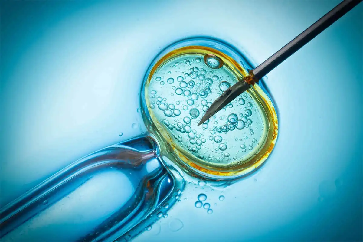Shot of an IVF procedure under a microscope